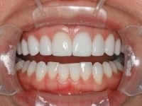 Konig Center for Cosmetic & Comprehensive Dentistry smile photos